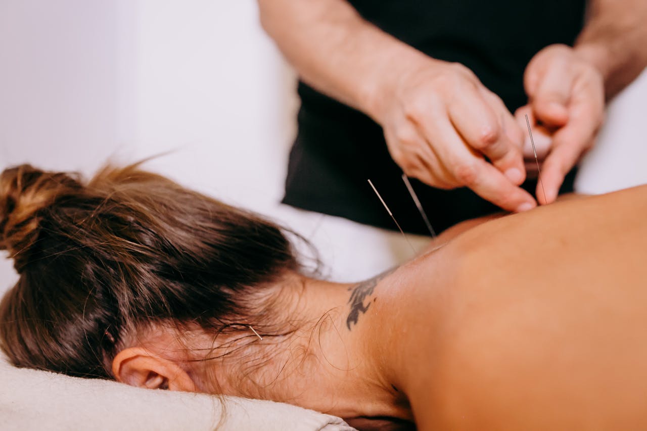 Acupuncture (2)